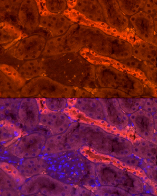 Tamm Horsfall Glycoprotein Rabbit polyclonal antibody