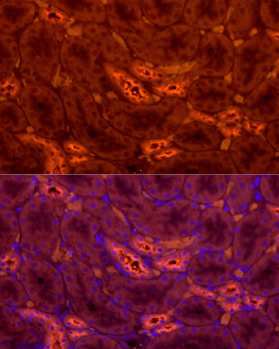 Tamm Horsfall Glycoprotein Rabbit polyclonal antibody