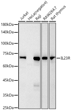 IL23R Rabbit monoclonal antibody