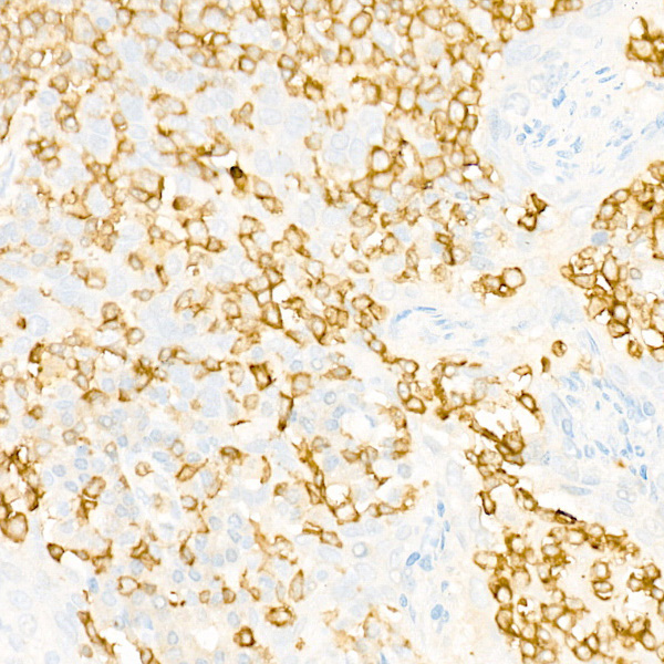 IL23R Rabbit monoclonal antibody