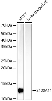 S100A11 Rabbit monoclonal antibody