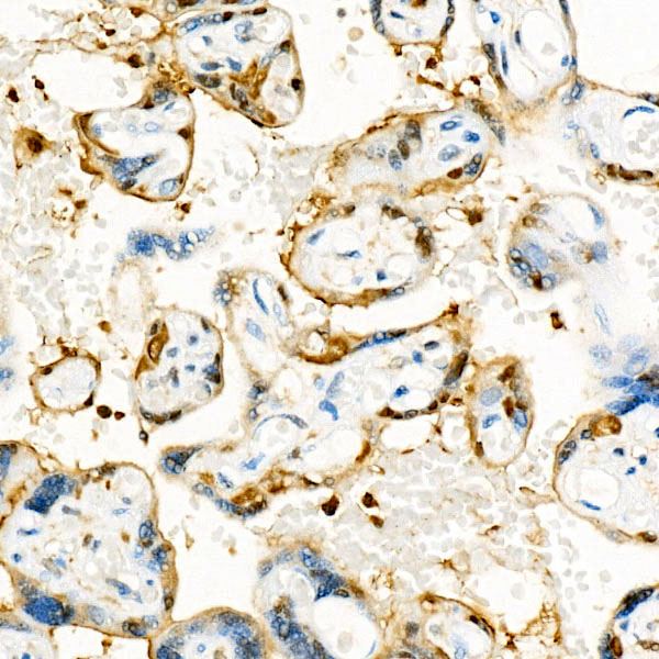 S100A11 Rabbit monoclonal antibody