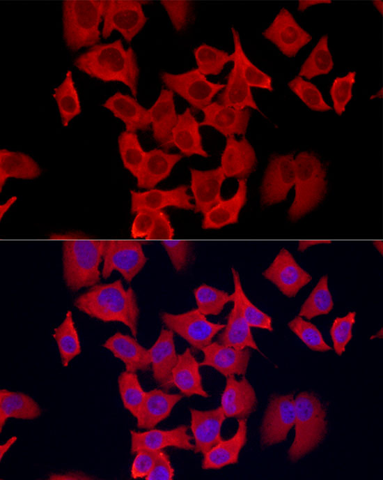 S100A11 Rabbit monoclonal antibody