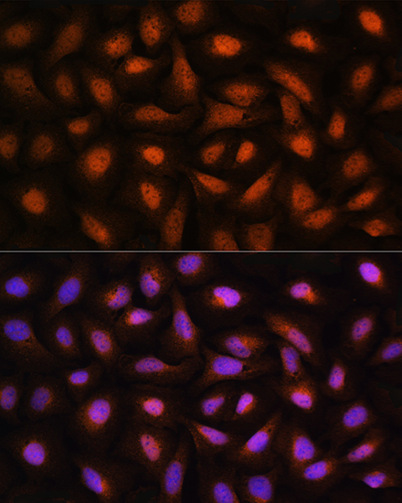 CTBP2 Rabbit polyclonal antibody