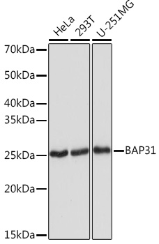 BAP31 Rabbit monoclonal antibody