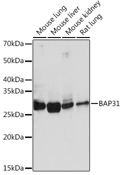 BAP31 Rabbit monoclonal antibody
