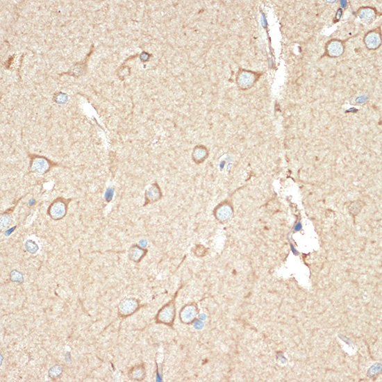 BAP31 Rabbit monoclonal antibody
