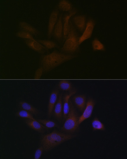 BAP31 Rabbit monoclonal antibody