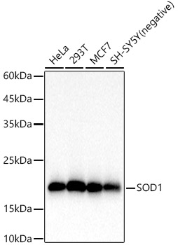 SOD1 Rabbit monoclonal antibody