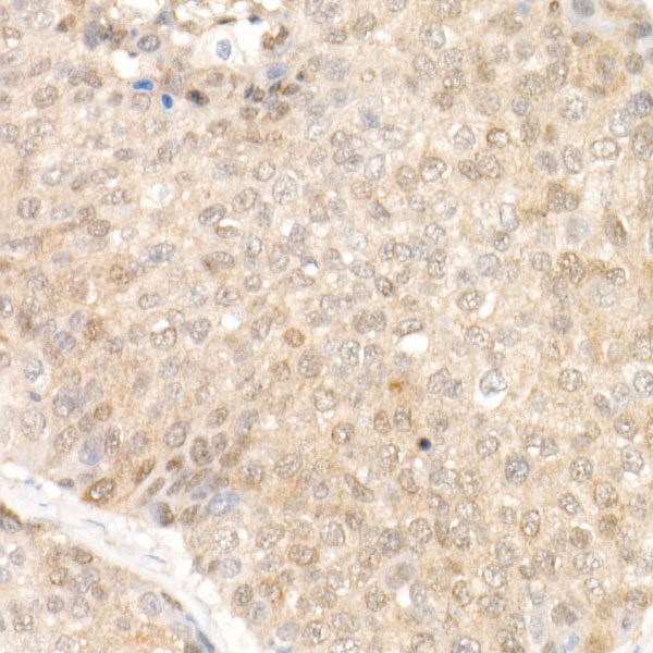 SOD1 Rabbit monoclonal antibody