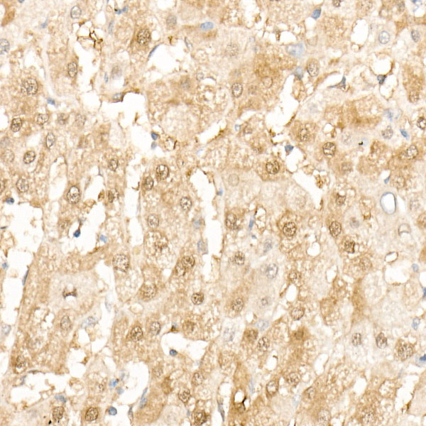 SOD1 Rabbit monoclonal antibody
