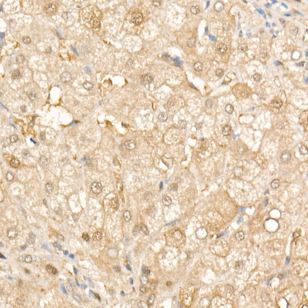 SOD1 Rabbit monoclonal antibody