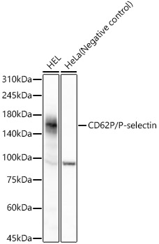 CD62P/P-selectin Rabbit mAb