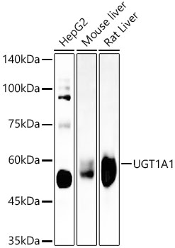 UGT1A1 Rabbit monoclonal antibody