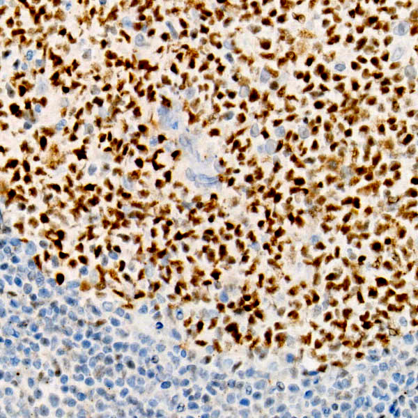 BCL6 Rabbit monoclonal antibody