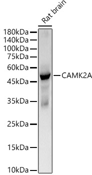 CAMK2A Rabbit monoclonal antibody