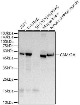 CAMK2A Rabbit monoclonal antibody