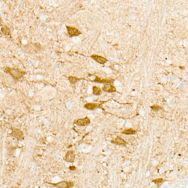 CAMK2A Rabbit monoclonal antibody