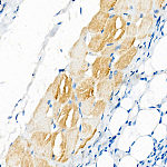 Western blot - SERCA1/ATP2A1 Rabbit mAb (A22614)