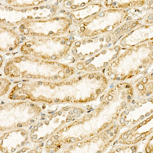 CYP24A1 Rabbit monoclonal antibody