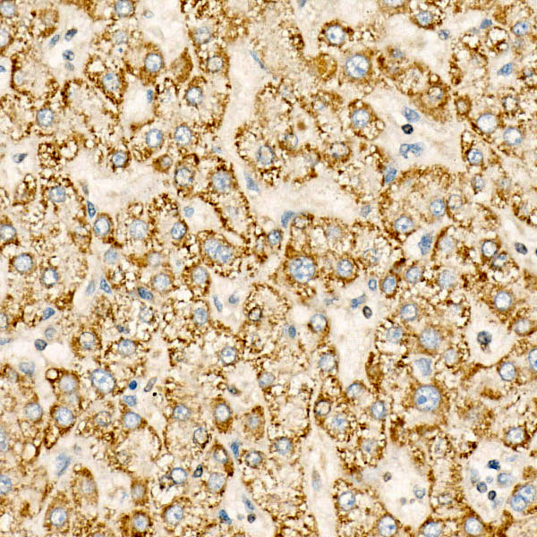 CYP24A1 Rabbit monoclonal antibody