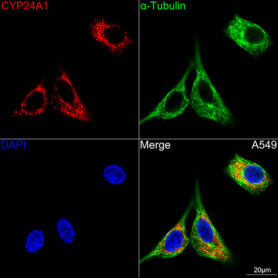 CYP24A1 Rabbit monoclonal antibody