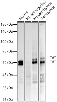 TdT Rabbit monoclonal antibody