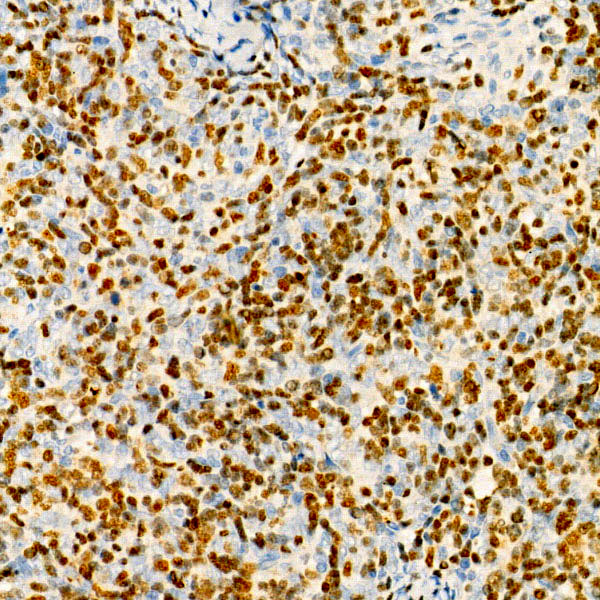 TdT Rabbit monoclonal antibody