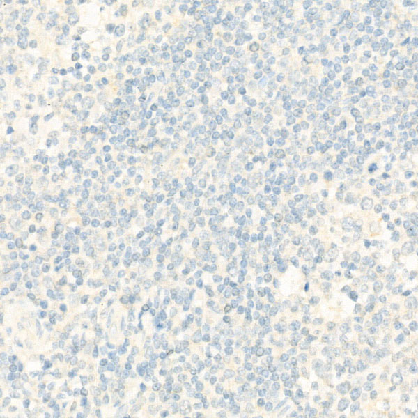 TdT Rabbit monoclonal antibody