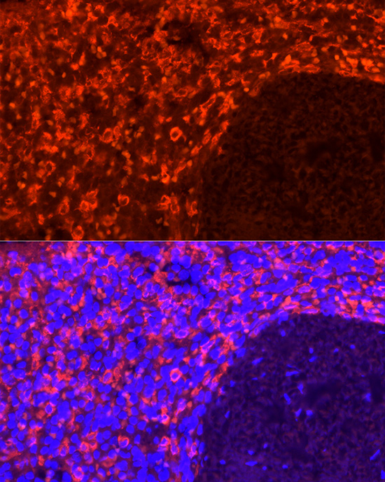 CD163 Rabbit monoclonal antibody