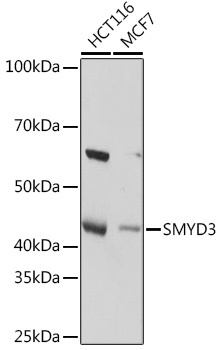 SMYD3 Rabbit monoclonal antibody