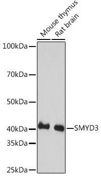 SMYD3 Rabbit monoclonal antibody