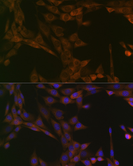 SMYD3 Rabbit monoclonal antibody