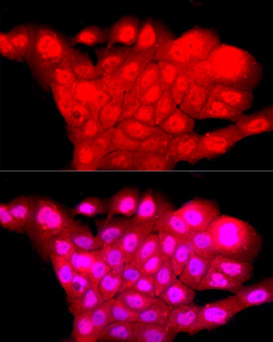 POU4F1Rabbit polyclonal antibody