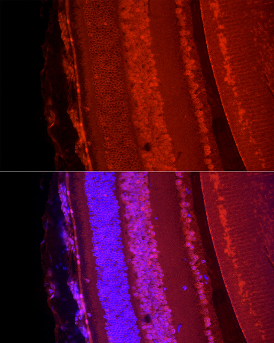 POU4F1Rabbit polyclonal antibody