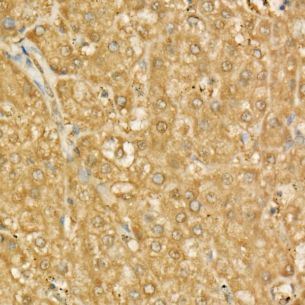 MIF Rabbit monoclonal antibody