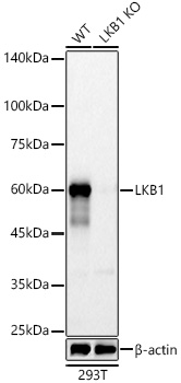 [KO Validated] LKB1 Rabbit monoclonal antibody