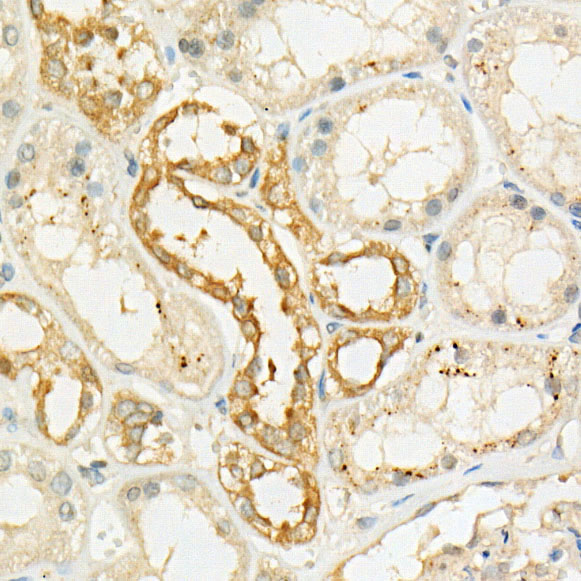 [KO Validated] LKB1 Rabbit monoclonal antibody