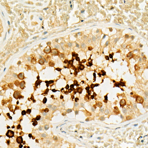 [KO Validated] LKB1 Rabbit monoclonal antibody