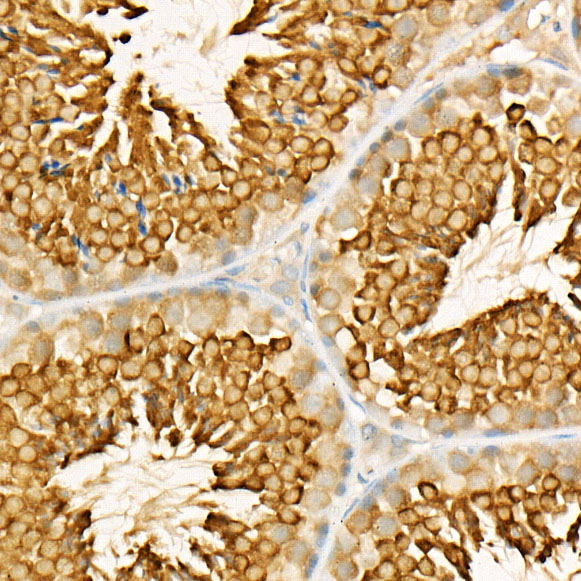 [KO Validated] LKB1 Rabbit monoclonal antibody