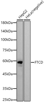 FTCD Rabbit monoclonal antibody