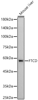 FTCD Rabbit monoclonal antibody