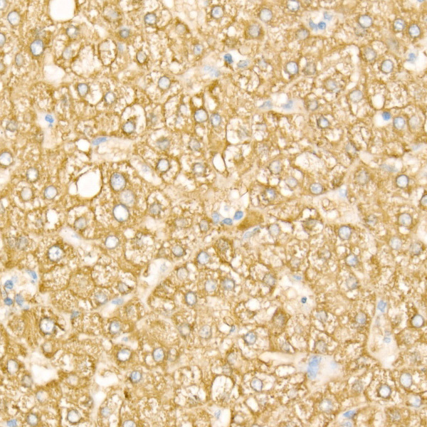 FTCD Rabbit monoclonal antibody