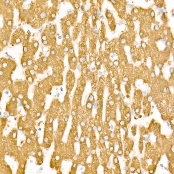 FTCD Rabbit monoclonal antibody