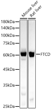 FTCD Rabbit monoclonal antibody