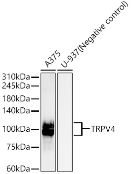 TRPV4 Rabbit monoclonal antibody