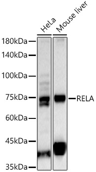 RELA Rabbit polyclonal antibody