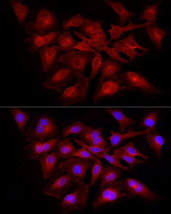 RELA Rabbit polyclonal antibody