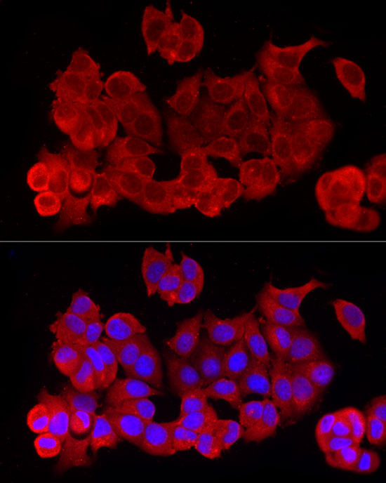 RELA Rabbit polyclonal antibody