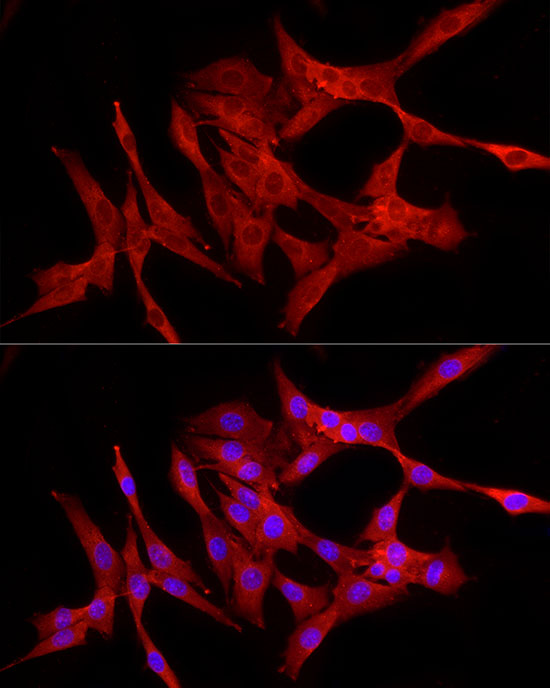 RELA Rabbit polyclonal antibody
